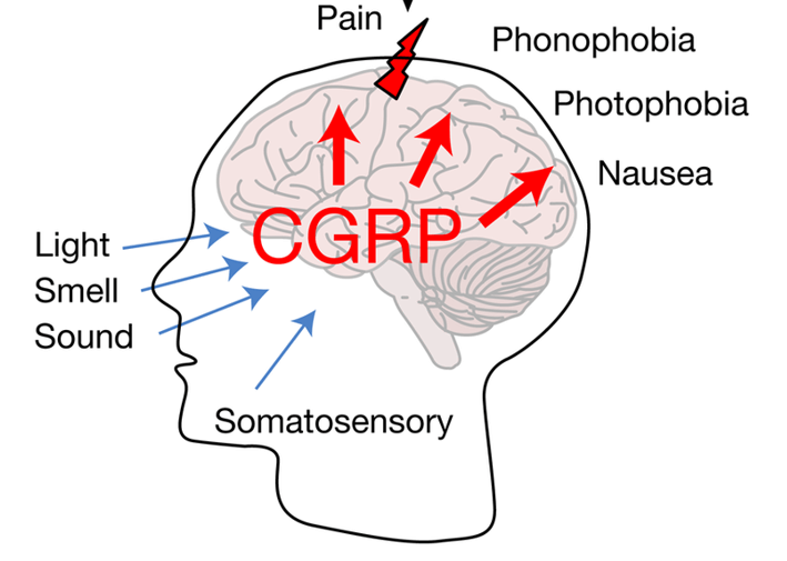 CGRP for Migraine
